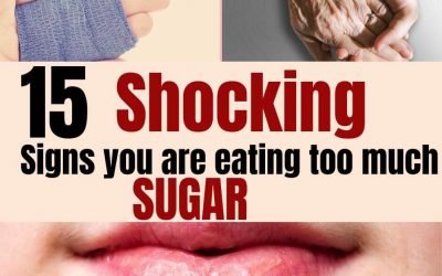 15 Shocking Signs You’re Eating Too Much Sugar